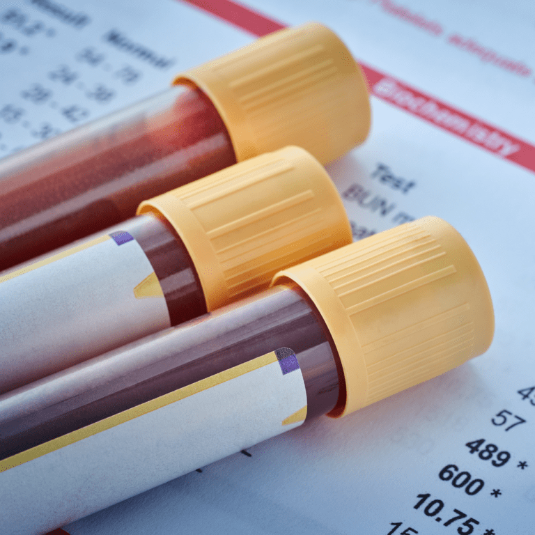 Labs Blood work Cincinnati
