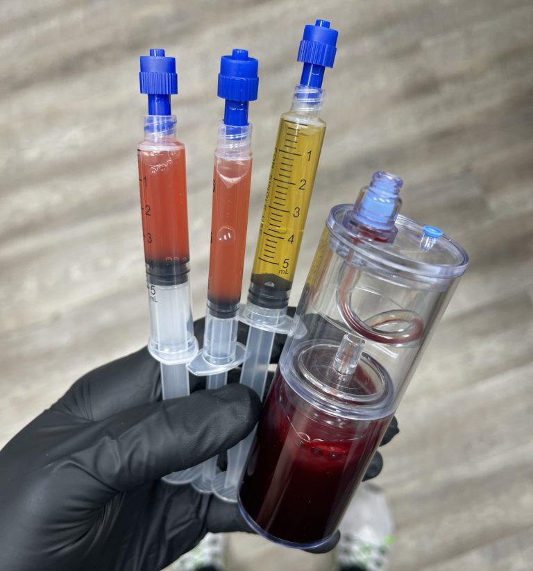 PRP Injection Treatment Cincinnati West Chester